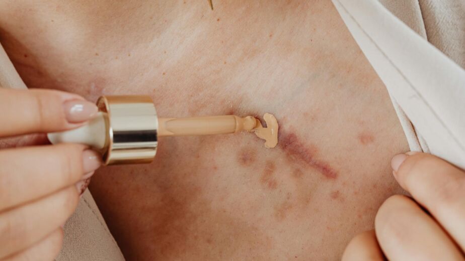 Reface Studio - Tratamiento láser dermatológico